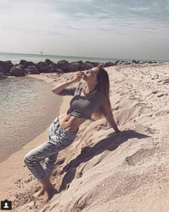 Belinda asusta a sus fans con raro cambio en sus piernas ¿Qué le pasó?