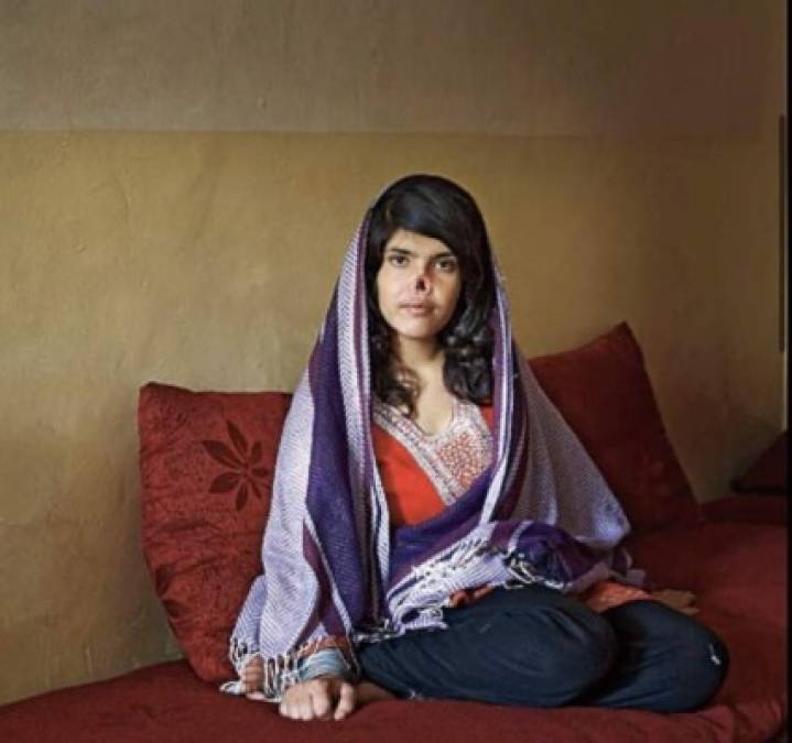 Aisha Mohammadzai, el rostro de la violencia de los talibanes contra las mujeres en Afganistán