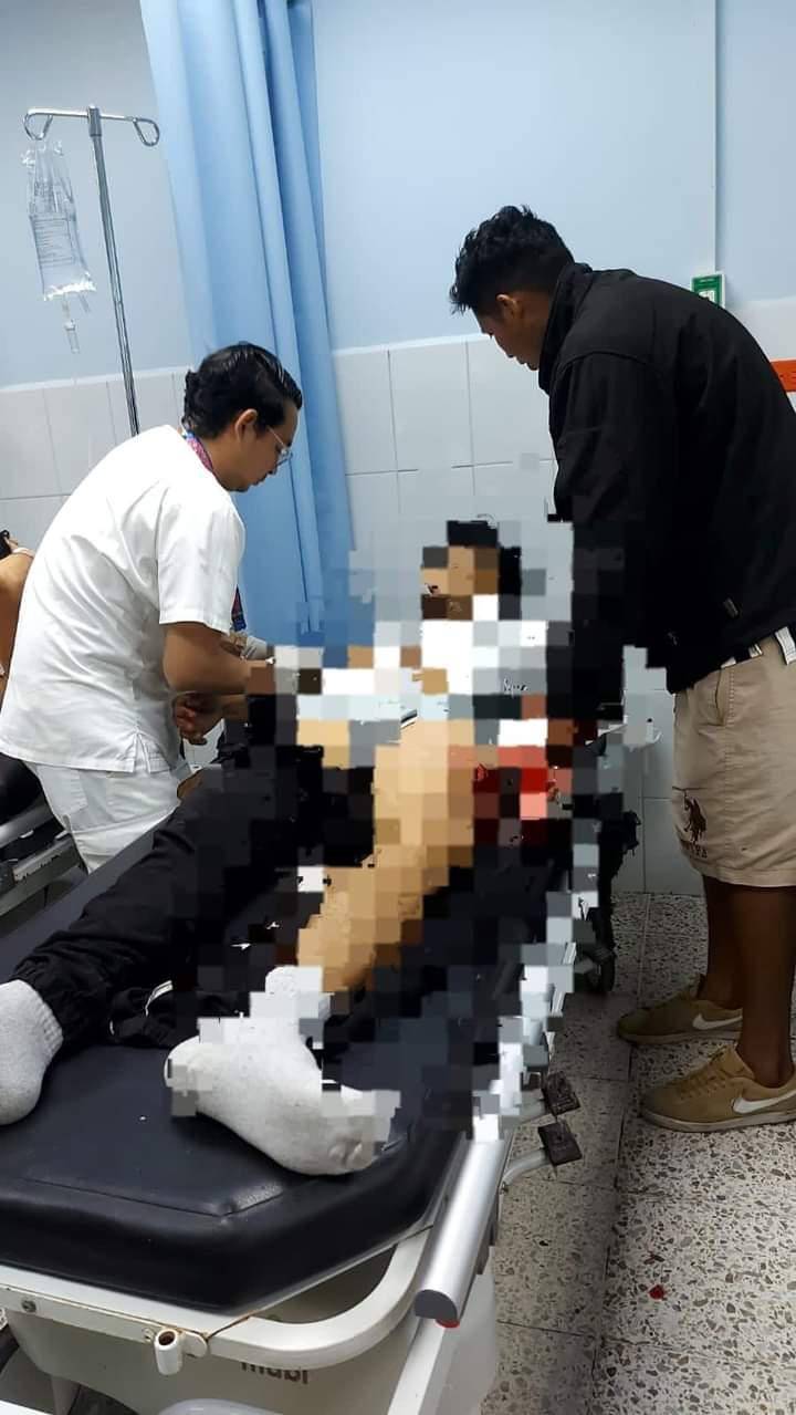 Joven muere tras estallarle un “cuete” en feria de Comayagua