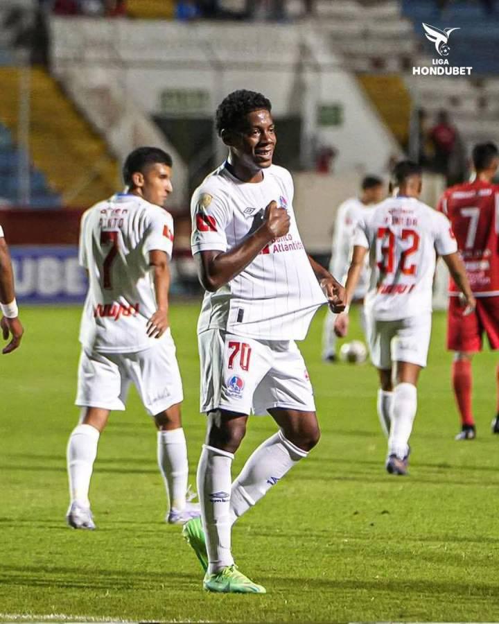 Jugadores que Rueda tuvo en el olvido serían las opciones para Honduras por los lesionados