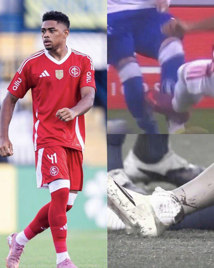 Jugador recibe insólito castigo luego de lesionar a su rival