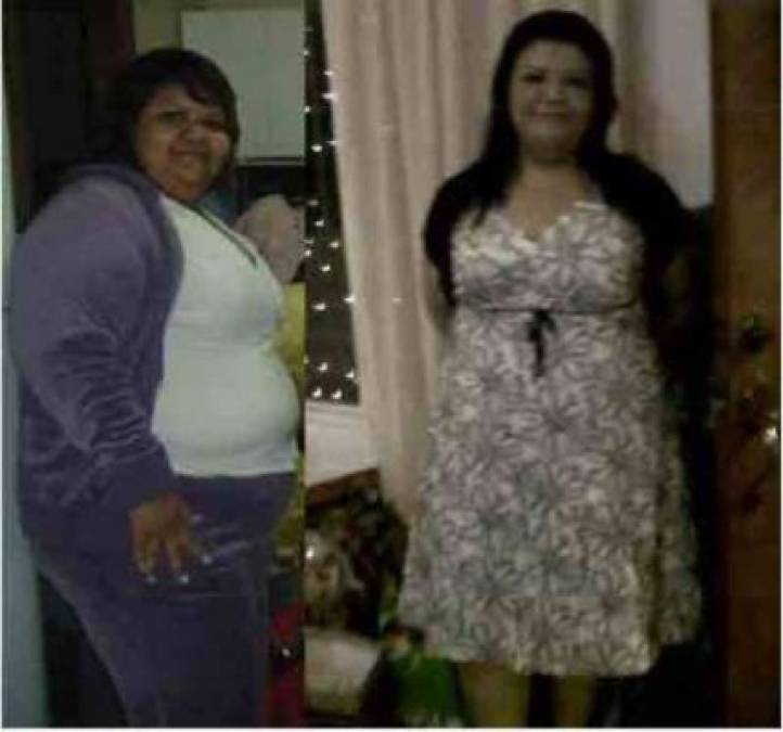 Fotos: Jazmín Islas y sus 86 kilos menos