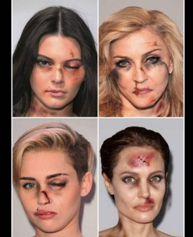 Campaña muestra fotos de celebridades como si fueran víctimas de violencia doméstica