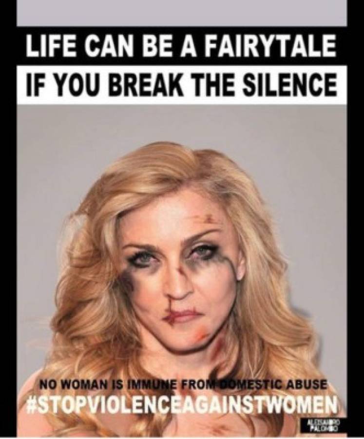 Campaña muestra fotos de celebridades como si fueran víctimas de violencia doméstica