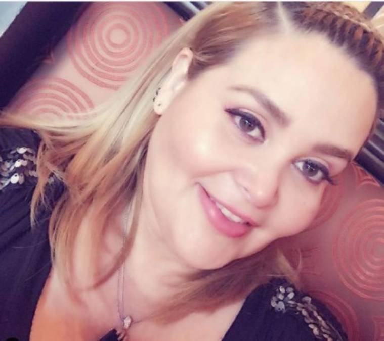 El sorprendente cambio de Sheyla Tadeo tras su drástica pérdida de peso
