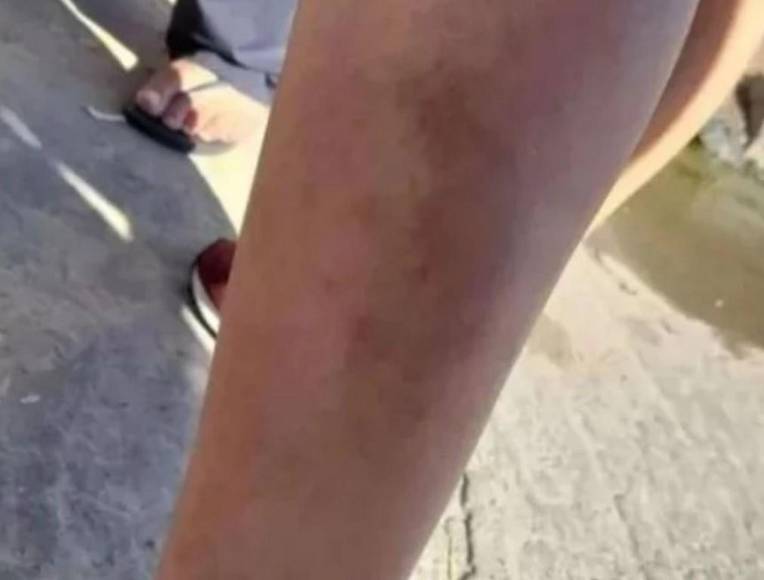 “Por si me mata”: joven envía su ubicación a amiga ante el terror que sentía con su pareja