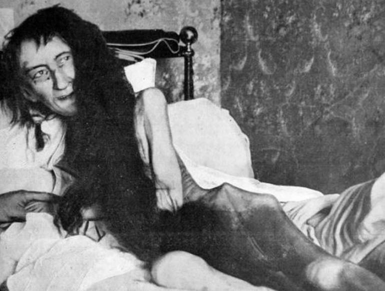 Blanche Monnier, la joven que vivió 25 años encerrada por su madre y logró ser rescatada gracias a una pista anónima (Fotos)