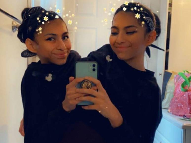 Una relación con estrictos acuerdos: así es el noviazgo de Daniel con Carmen, siamesa que comparte pelvis con su hermana