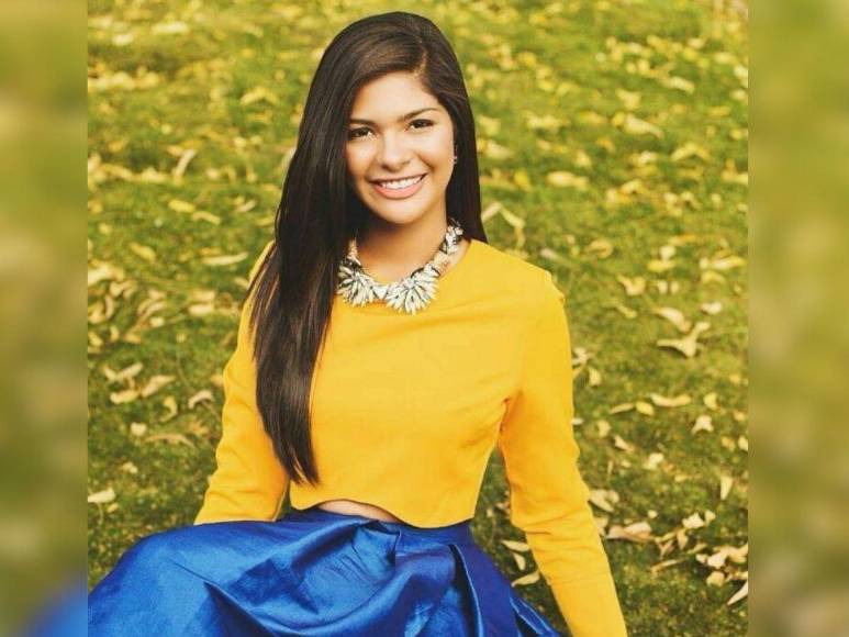 ¿Cuáles son las cirugías plásticas de Miss Universo, Sheynnis Palacios?