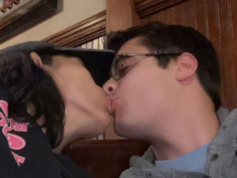 Una relación con estrictos acuerdos: así es el noviazgo de Daniel con Carmen, siamesa que comparte pelvis con su hermana