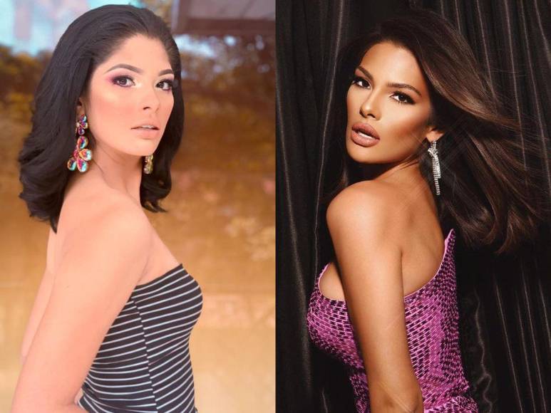 ¿Cuáles son las cirugías plásticas de Miss Universo, Sheynnis Palacios?