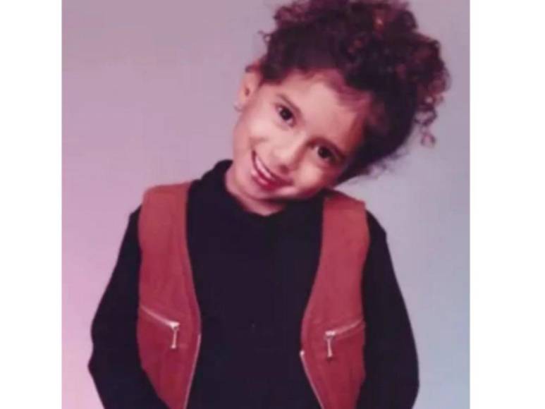 Rinosplatia, reducción de pechos y remoción de quijada: el cambio físico de Anitta gracias a las cirugías plásticas