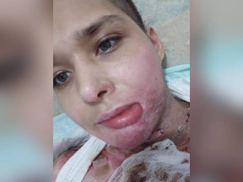 Joven fue secuestrada, violada y quemada por su arrendador en México