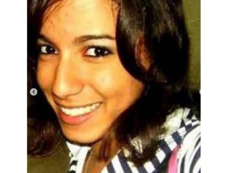 Rinosplatia, reducción de pechos y remoción de quijada: el cambio físico de Anitta gracias a las cirugías plásticas