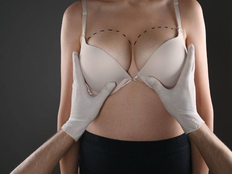 Las cuatros cirugías plásticas más populares entre las estrellas del K-pop