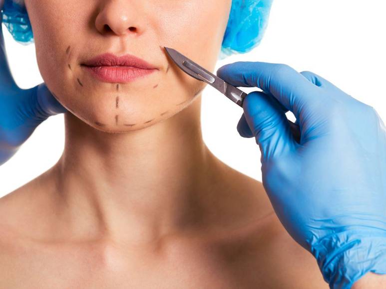 Las cuatros cirugías plásticas más populares entre las estrellas del K-pop