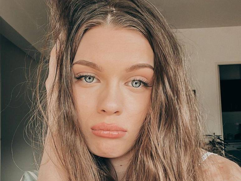 Olympe, la influencer francesa que batalla contra su salud mental y pide muerte asistida