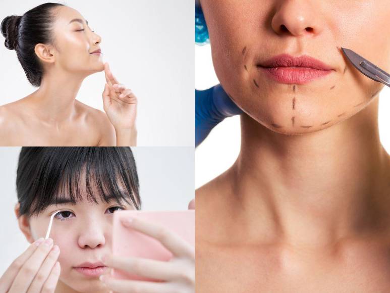 Las cuatros cirugías plásticas más populares entre las estrellas del K-pop