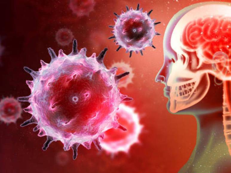 ¿Qué es la meningitis bacteriana? La verdadera causa de muerte de Cristina Lagos