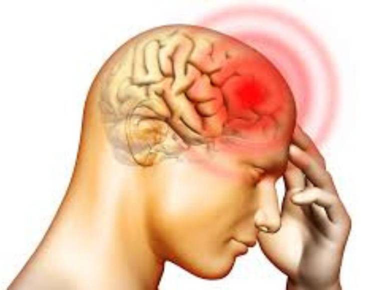 ¿Qué es la meningitis bacteriana? La verdadera causa de muerte de Cristina Lagos