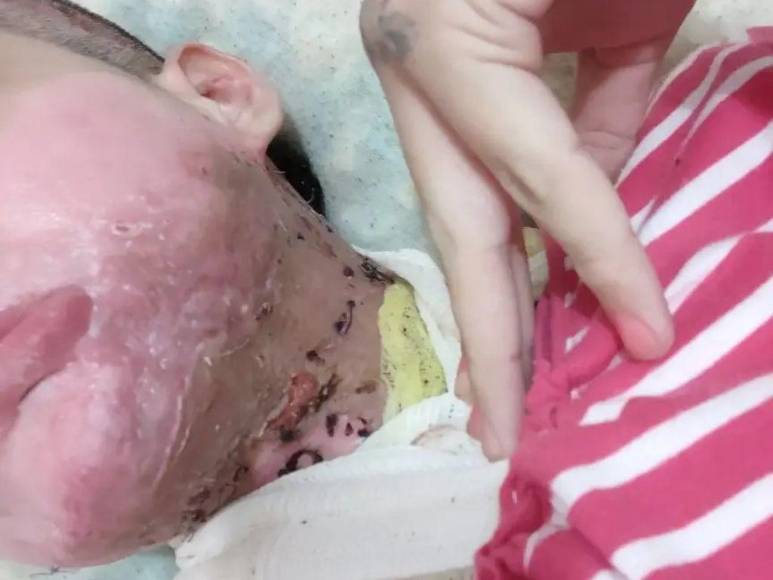 Joven fue secuestrada, violada y quemada por su arrendador en México