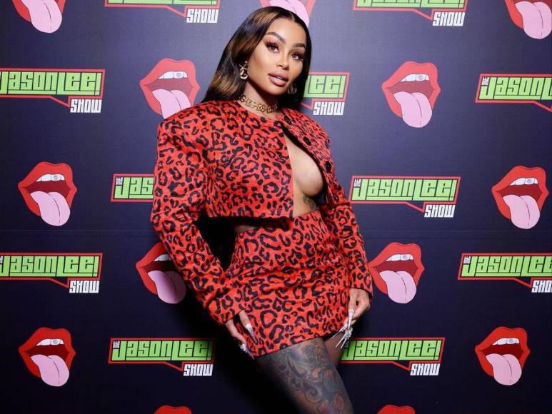 Blac Chyna retira sus implantes de rostro, senos y glúteos