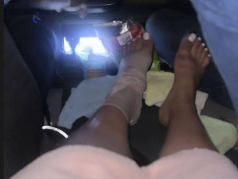 Alejandra Rubio se lesiona el pie en Carnaval de La Ceiba al esquivar un caballo