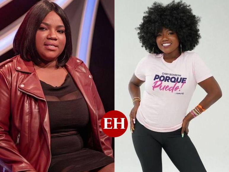 El increíble cambio físico de la Chiky Bombom tras someterse a bypass gástrico