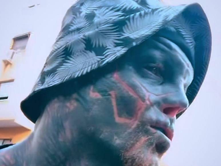 Black Alien pone fin a transformación: “Ya no quiero tocar mi cuerpo”