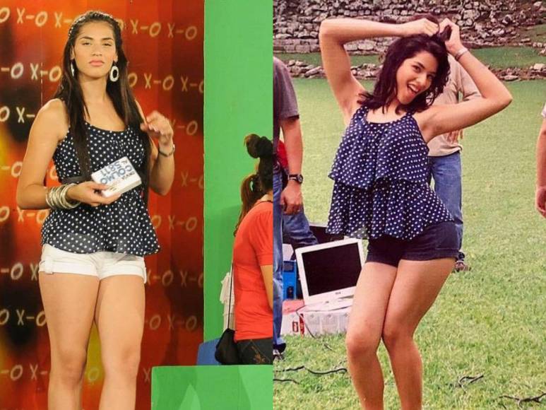 El antes y después de Carolina Lanza: la historia detrás de su sorprendente cambio físico