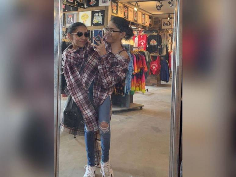 Una relación con estrictos acuerdos: así es el noviazgo de Daniel con Carmen, siamesa que comparte pelvis con su hermana