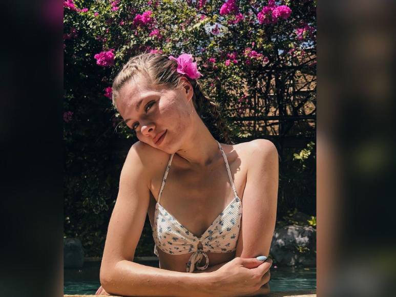 Influencer francesa de 23 años solicita eutanasia tras vivir una infancia de abusos y acoso escolar