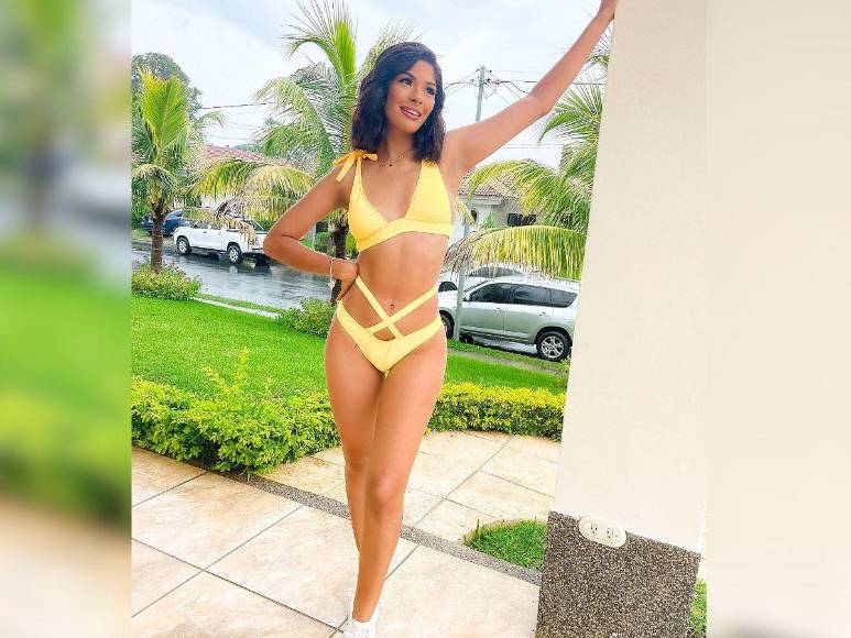 ¿Cuáles son las cirugías plásticas de Miss Universo, Sheynnis Palacios?