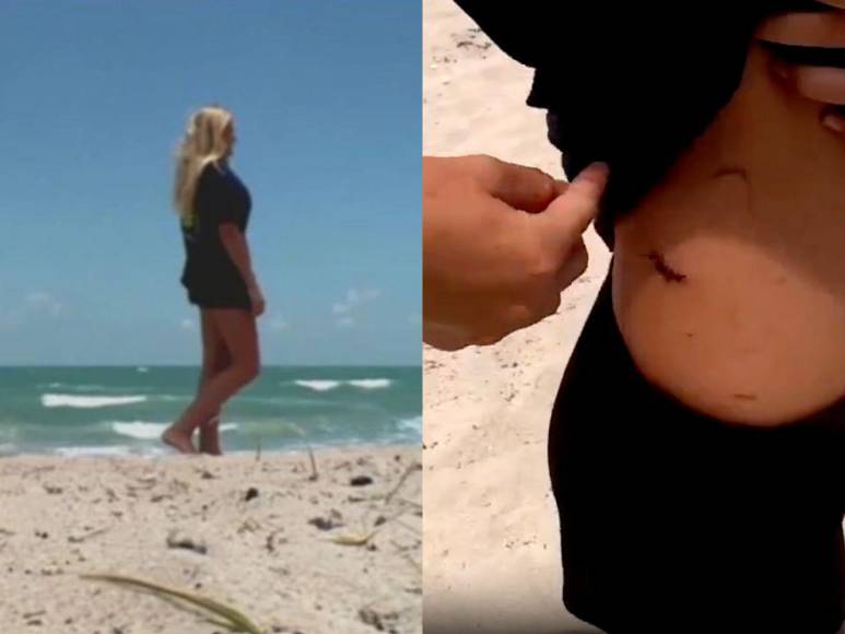 Ellen Reed, la niña de 13 años que peleó contra un tiburón en Florida