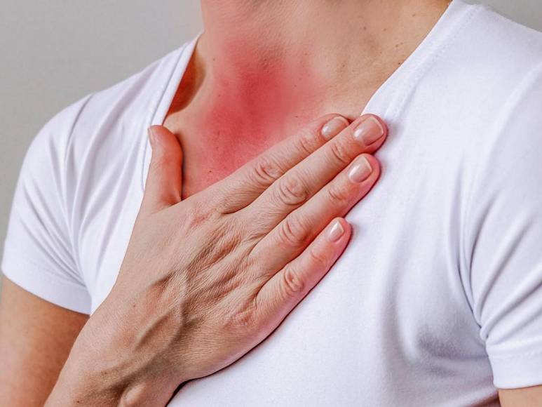 ¿Qué es bronquitis aguda, enfermedad diagnosticada a la presidenta Xiomara Castro?