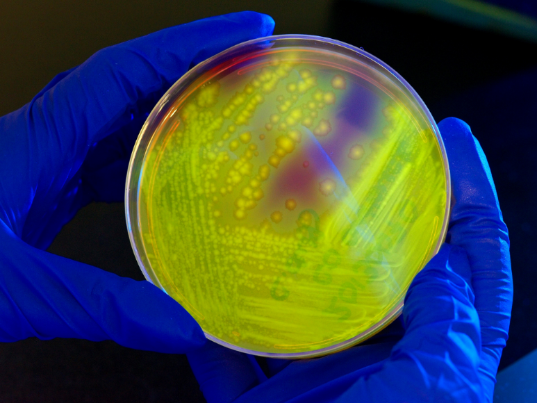 ¿Por qué las superbacterias son la nueva gran amenaza?