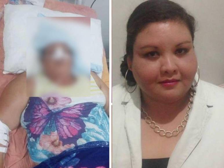 ¿Fue por extracción de muela? Revelan las causas de muerte de la hondureña Cristina Lagos en Hospital del Sur