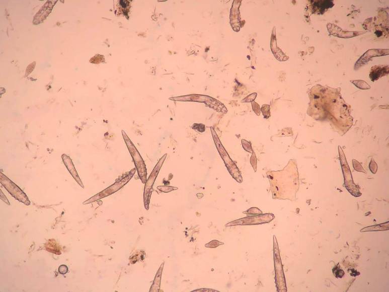 Los ácaros que viven en nuestra cara y que pronto se convertirán en parte de los humanos