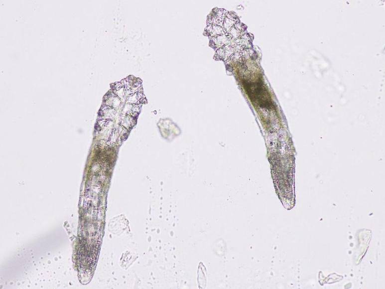 Los ácaros que viven en nuestra cara y que pronto se convertirán en parte de los humanos