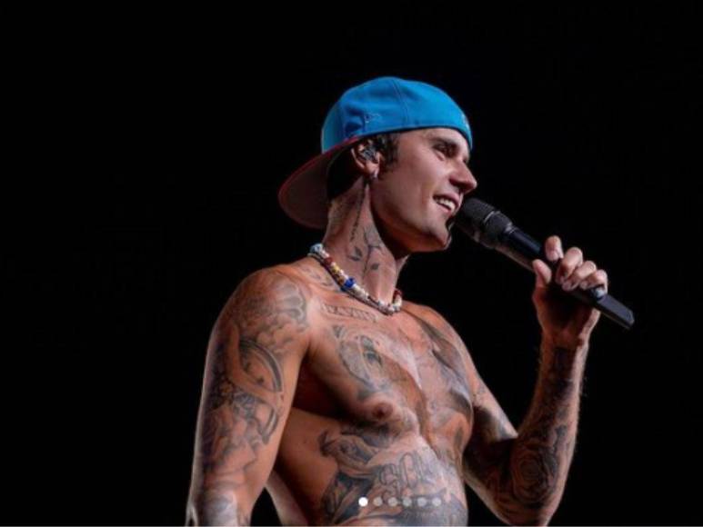 ¿Qué es el síndrome de Ramsay Hunt, causante de la parálisis facial de Justin Bieber?