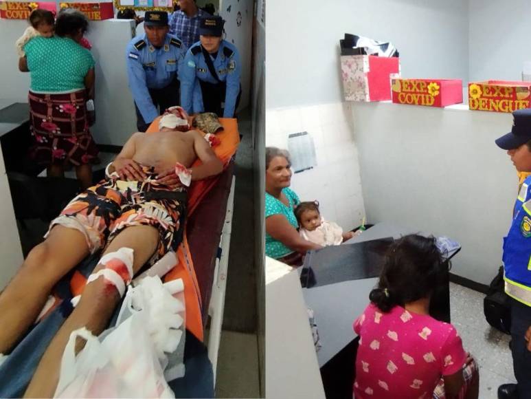 Así fue el fatal accidente que dejó dos muertos y siete heridos en Olanchito, Yoro