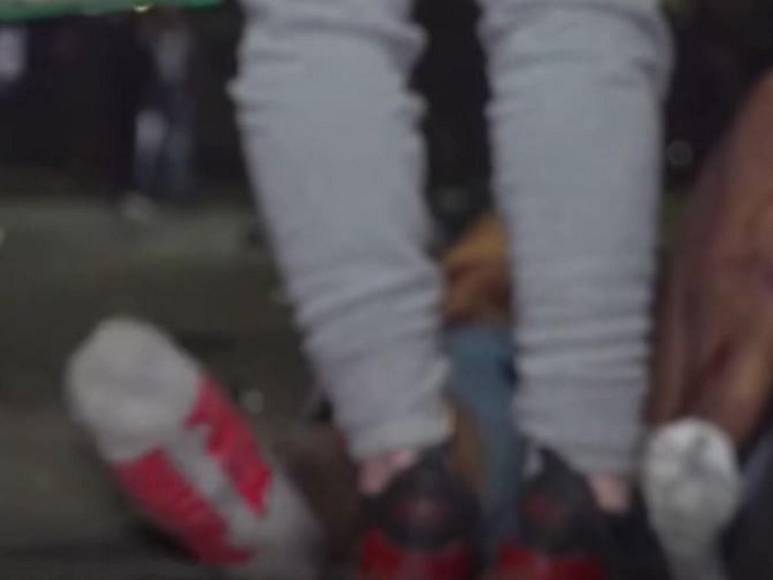 Hasta el tendido eléctrico fue a dar parte de moto tras choque en contra vía en anillo periférico