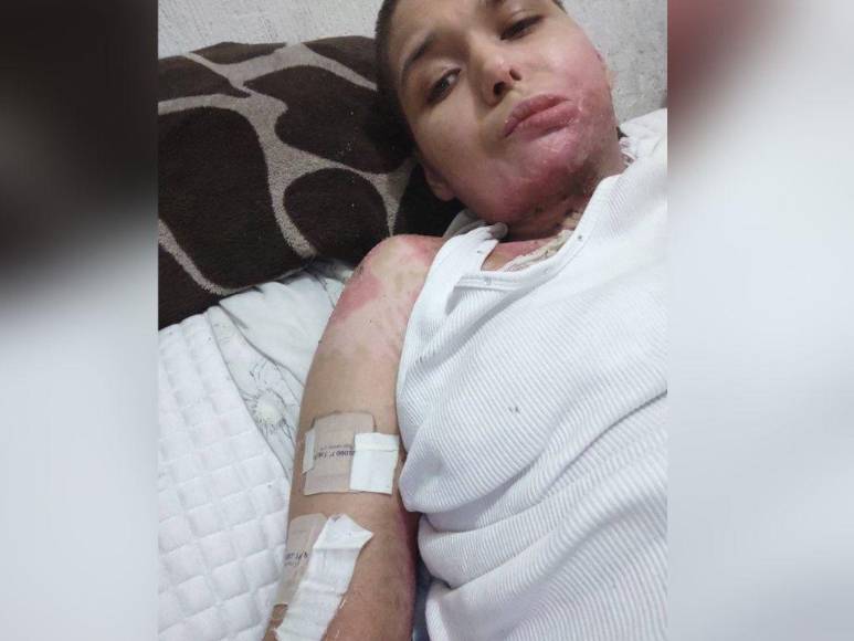 Joven fue secuestrada, violada y quemada por su arrendador en México