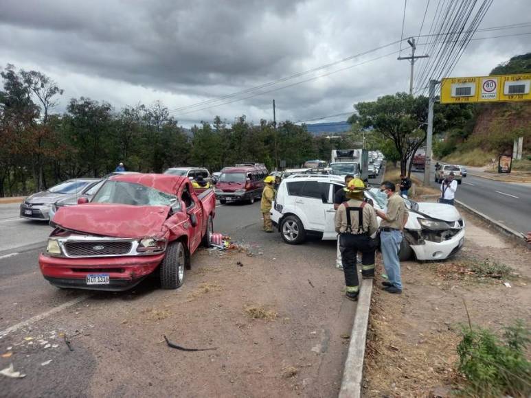 Explosión de llanta y alta velocidad: lo que habría originado accidente en anillo periférico