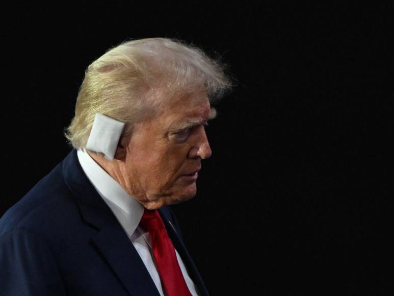 Entre aplausos y con la oreja vendada: Trump asiste a convención republicana