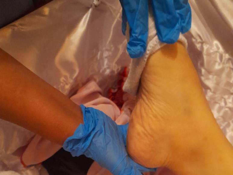 Golpes, moretones y signos de violencia: el impactante hallazgo en el cuerpo de doctora estrangulada en La Ceiba