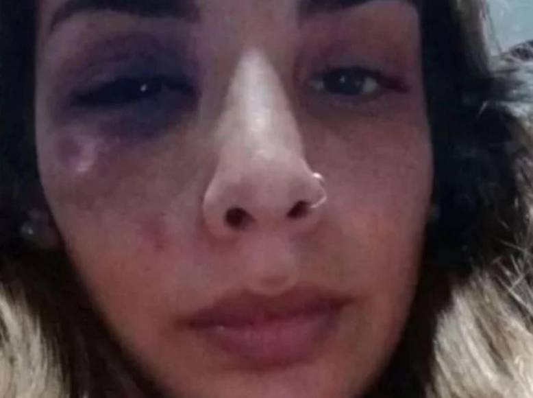 “Por si me mata”: joven envía su ubicación a amiga ante el terror que sentía con su pareja