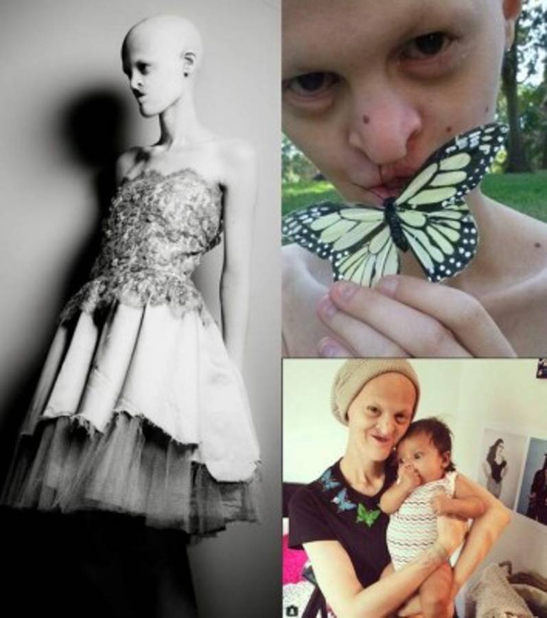 Modelo con inusual apariencia rompe estereotipos de belleza