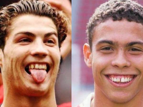 Algunos lucen irreconocibles luego de pasar por el dentista. Conoce que deportistas internacionales decidieron reparar su sonrisa.