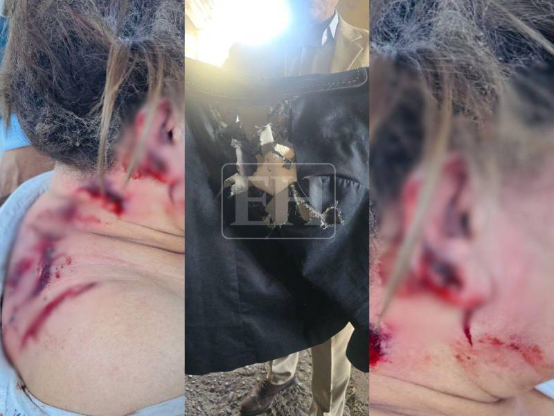 La diputada al Parlamento Centroamericano (Parlacen), Gladys Aurora López, resultó con heridas de consideración luego del atentado ocurrido en las instalaciones del Congreso Nacional.